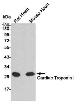 Troponin I Ab