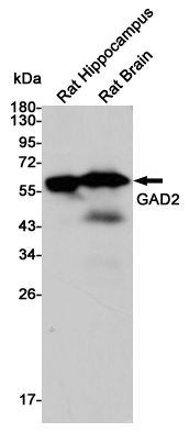 Glutamate decarboxylase 2 Ab