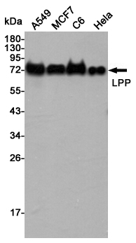 Lipoma preferred partner Ab