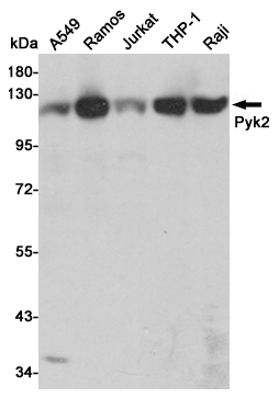 PTK2B Ab