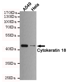 Cytokeratin 18 Ab