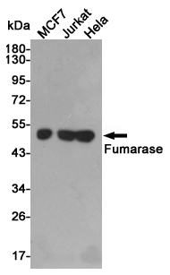 Fumarase Ab