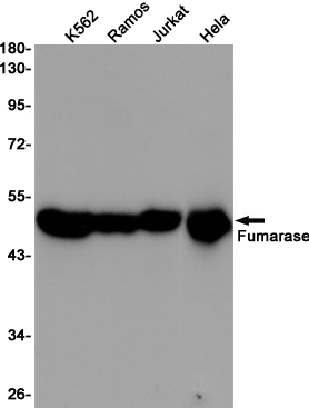 Fumarase Ab