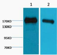 EGFR Ab