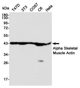 alpha Skeletal muscle actin Ab