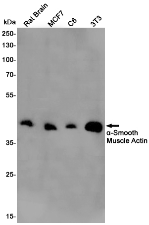 alpha Smooth muscle actin Ab