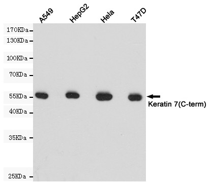 Cytokeratin 7 Ab