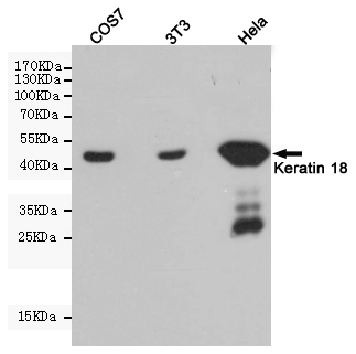 Cytokeratin 18 Ab