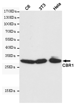CBR1 Ab