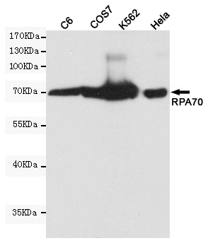 RPA p70 Ab