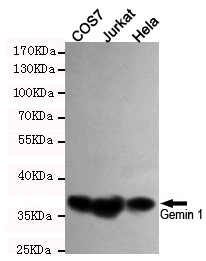 SMN1 Ab