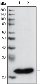 GSTP1 Ab