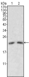 Apolipoprotein M Ab