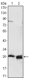 Apolipoprotein A1 Ab