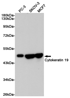 Cytokeratin 19 Ab