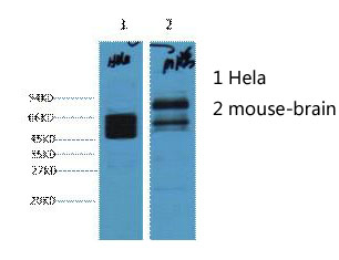 Cytokeratin 8 Ab