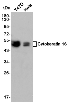 Cytokeratin 16 Ab