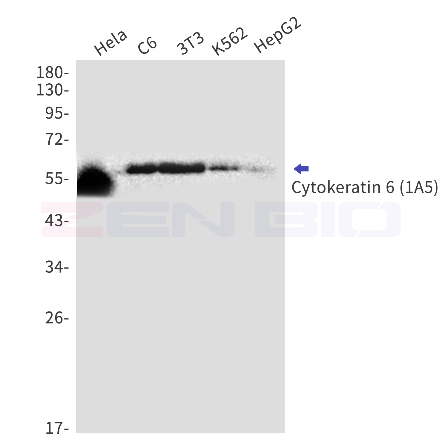 Cytokeratin 6A Ab