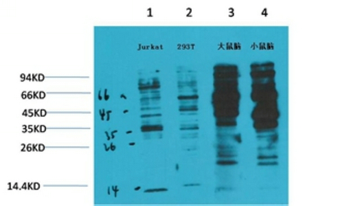 p-Tyrosine Ab