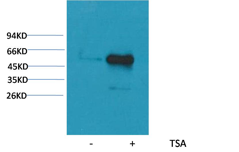 Acetyl-alpha 1B Tubulin (K40) Ab