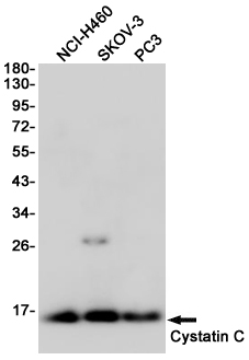 Cystatin C Ab