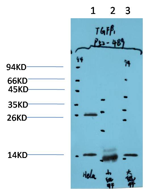 TGF beta 1 Ab