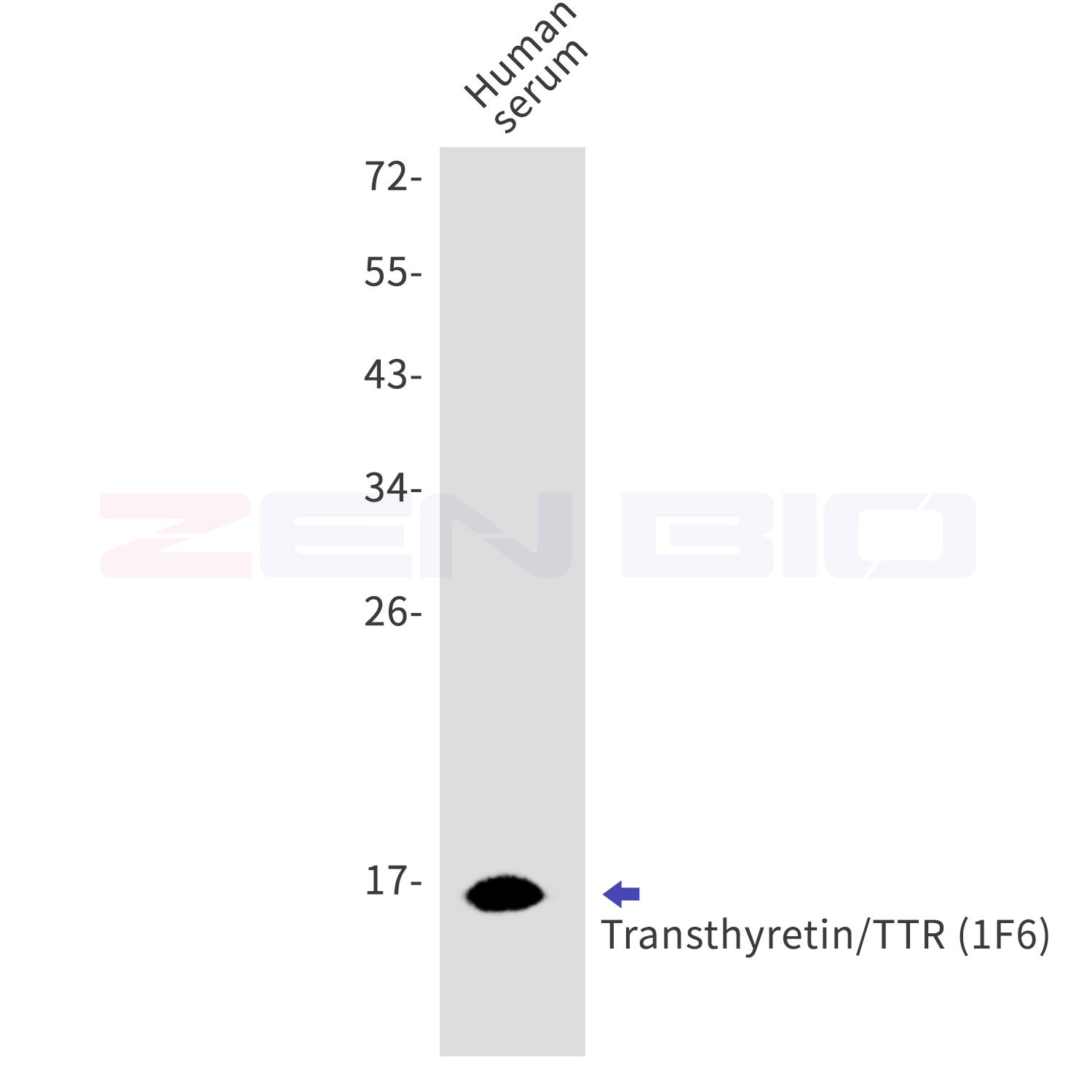 Transthyretin Ab