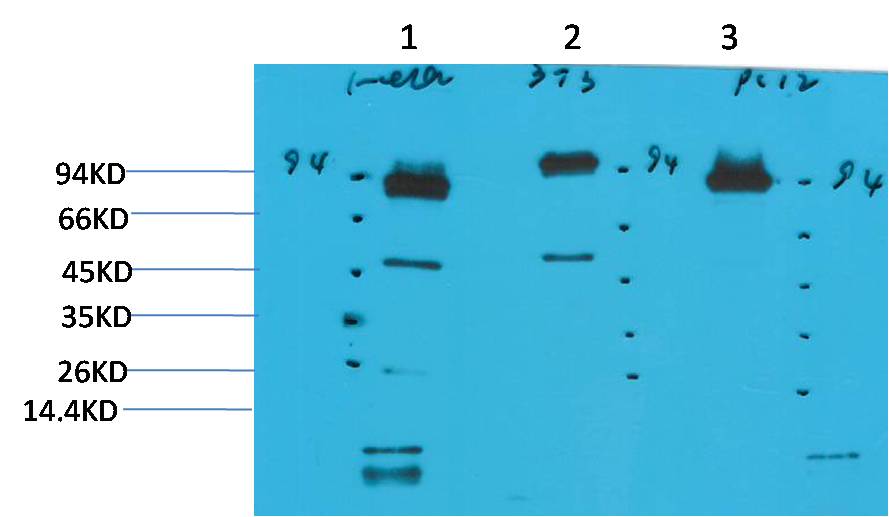 STAT3 Ab