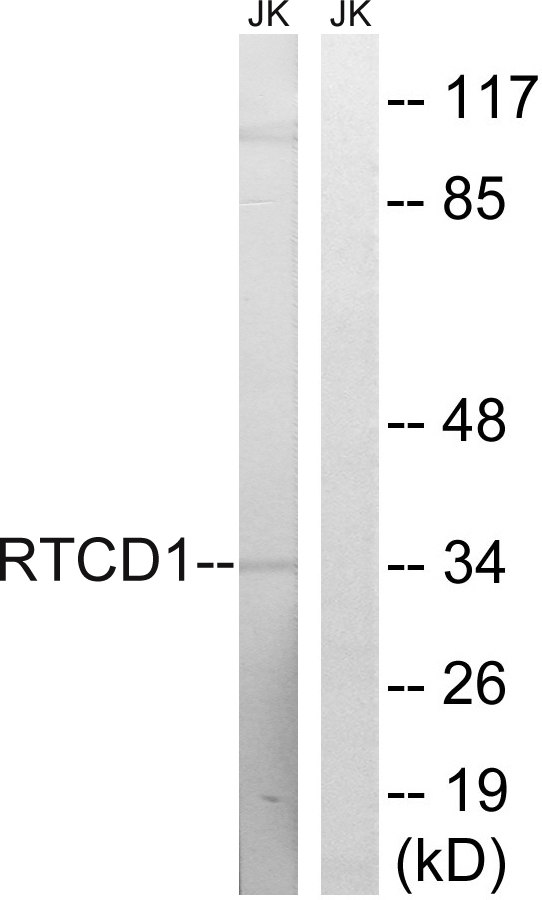 RNA cyclase Ab