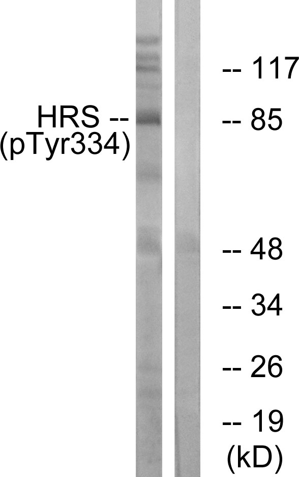 p-HGS (Y334) Ab