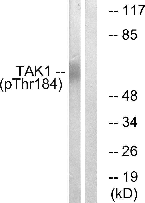 p-TAK1 (T184) Ab