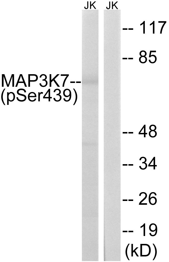 p-TAK1 (S439) Ab