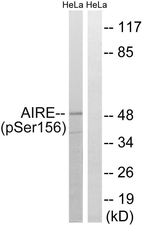 p-AIRE (S156) Ab