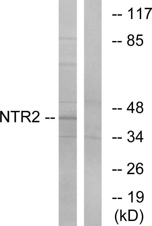 Neurotensin receptor type 2 Ab