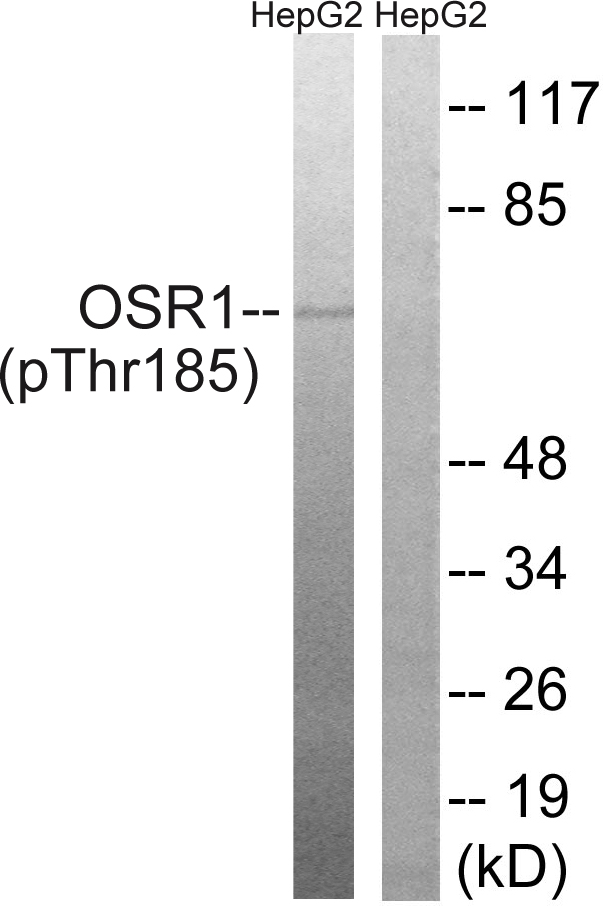 p-OXSR1 (T185) Ab