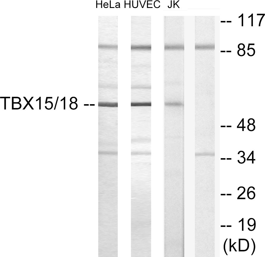 TBX15/18 Ab