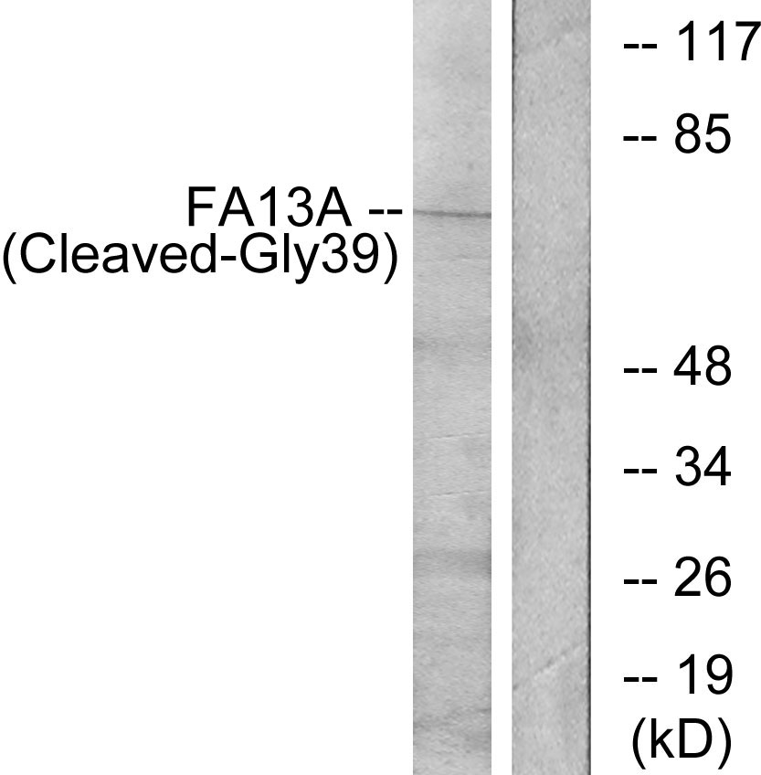 Coagulation factor XIII A chain Ab