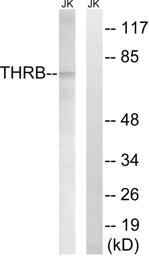 Prothrombin Ab