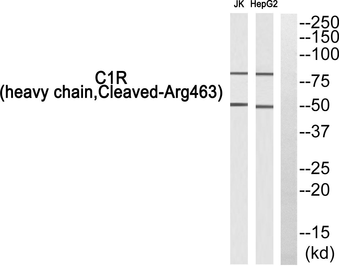 Complement C1r heavy chain Ab