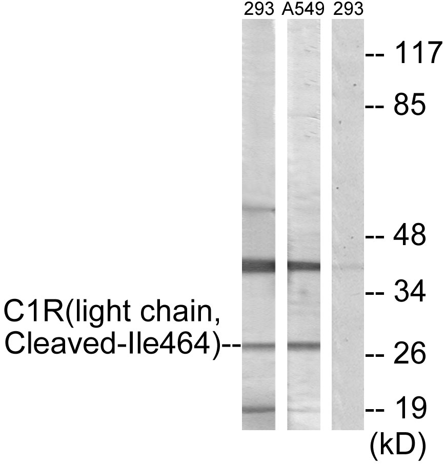 Complement C1r light chain Ab