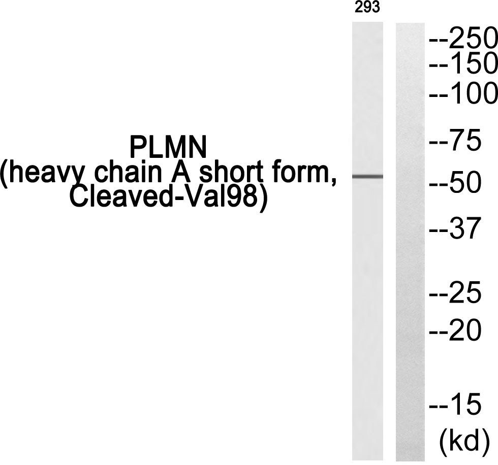 Plasminogen heavy chain Ab