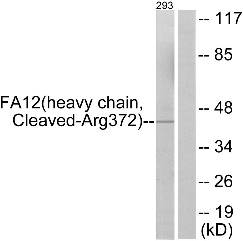 Coagulation factor XII heavy chain Ab