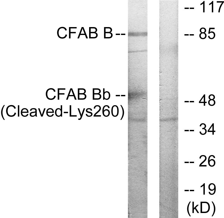 Complement factor B Ab