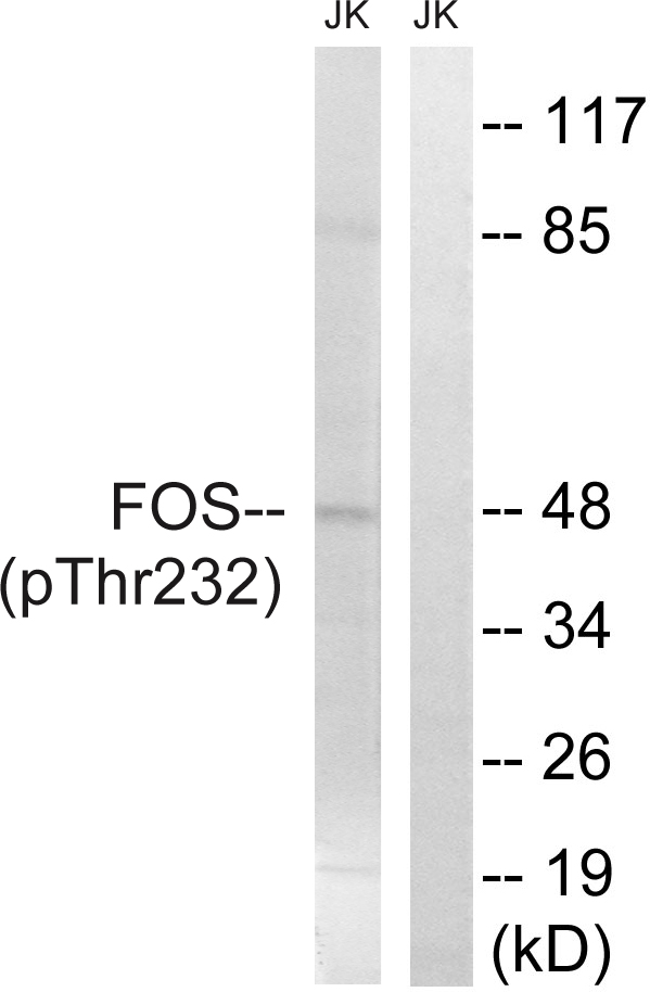 p-c Fos (T232) Ab