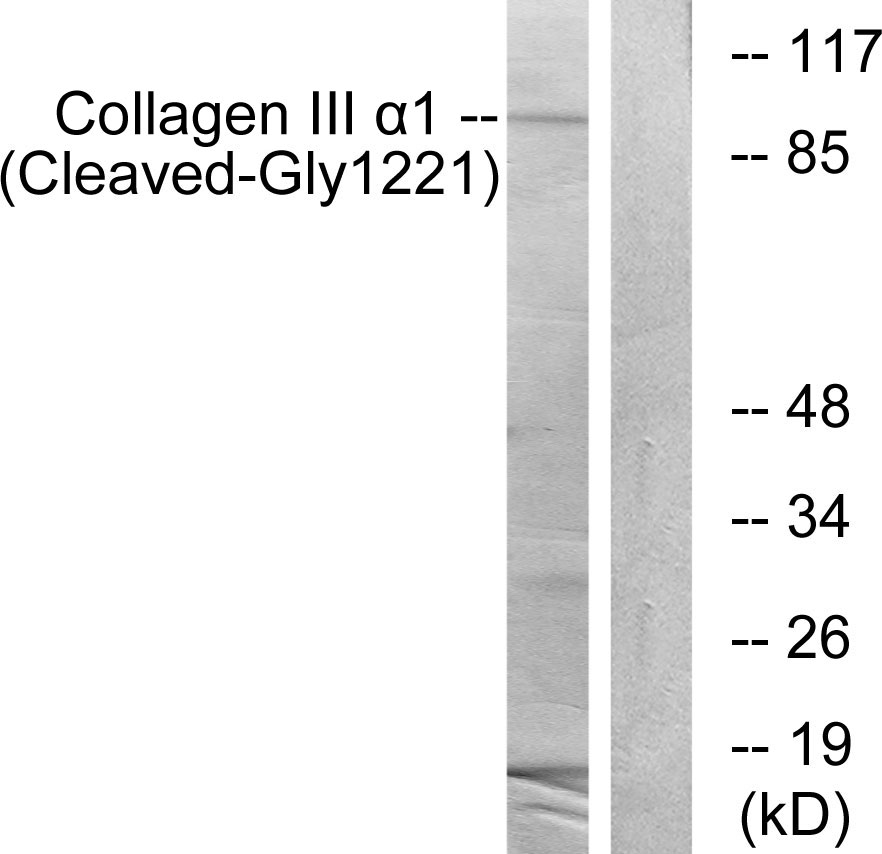 Collagen III alpha 1 Ab