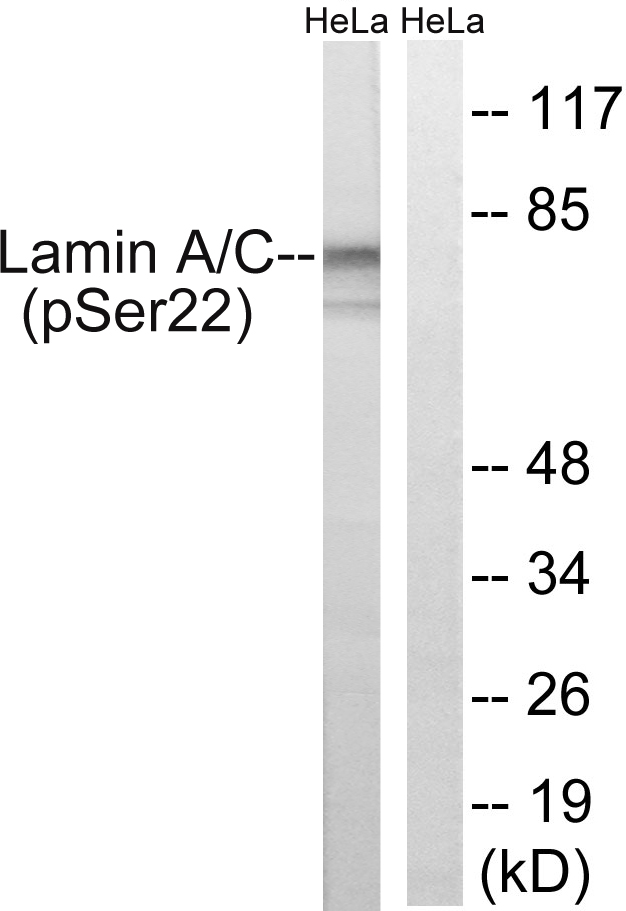 p-Lamin A/C (S22) Ab