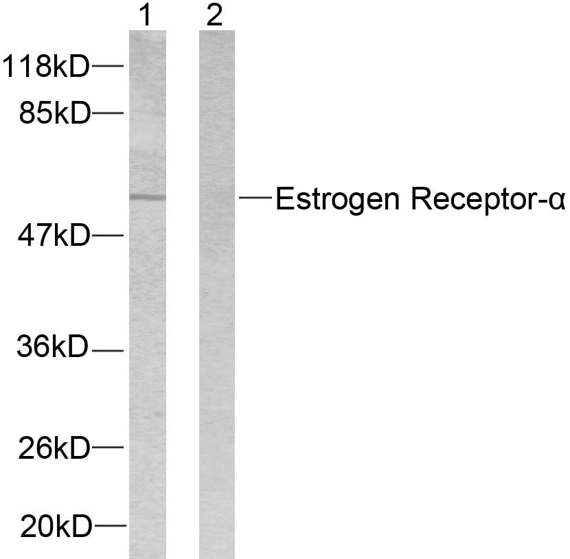 Estrogen receptor Ab