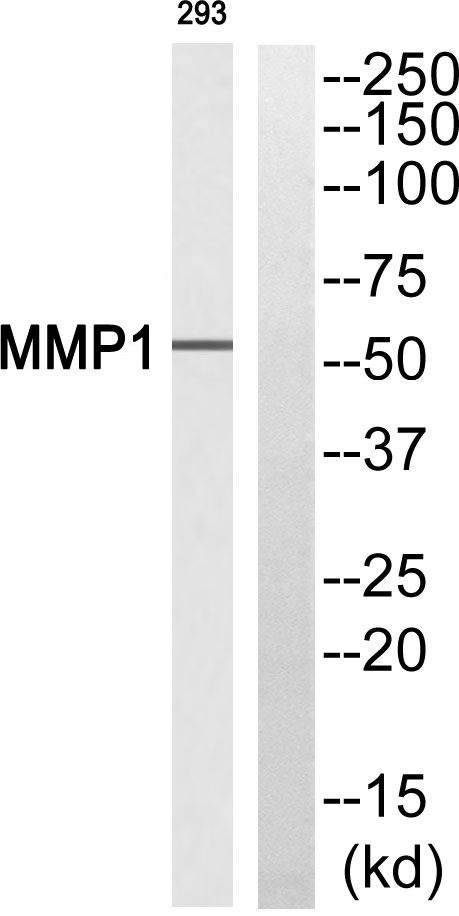 Cleaved-MMP1 (P269) Ab