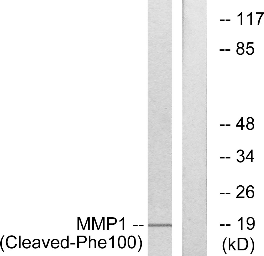 Cleaved-MMP1 (F100) Ab