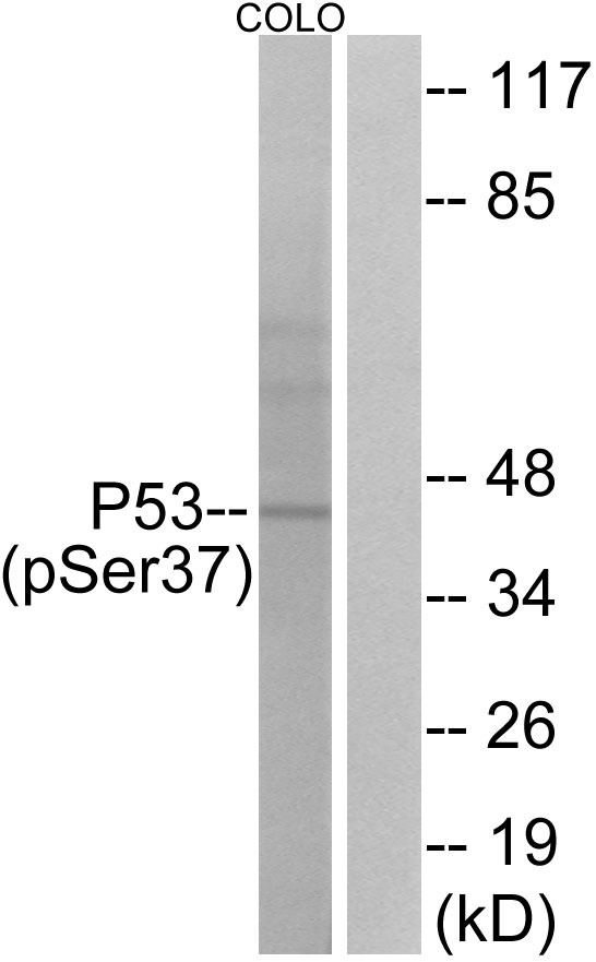 p-p53 (S37) Ab